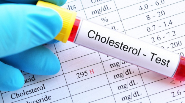   Cần khám sàng lọc để phát hiện, điều trị sớm bệnh tăng cholesterol máu gia đình di truyền, tránh biến chứng nguy hiểm. Ảnh minh họa  