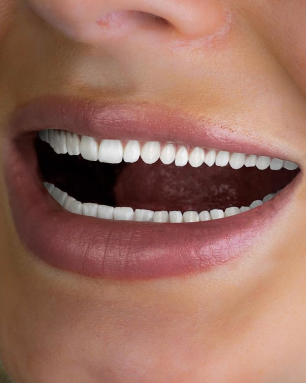   Quảng cáo của sản phẩm chăm sóc răng: Chúng tôi sẽ làm trắng 'tất cả' những chiếc răng của bạn  