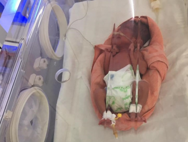   Bé gái sơ sinh nguy kịch vì được mẹ sinh tại nhà được các bác sĩ cứu sống  