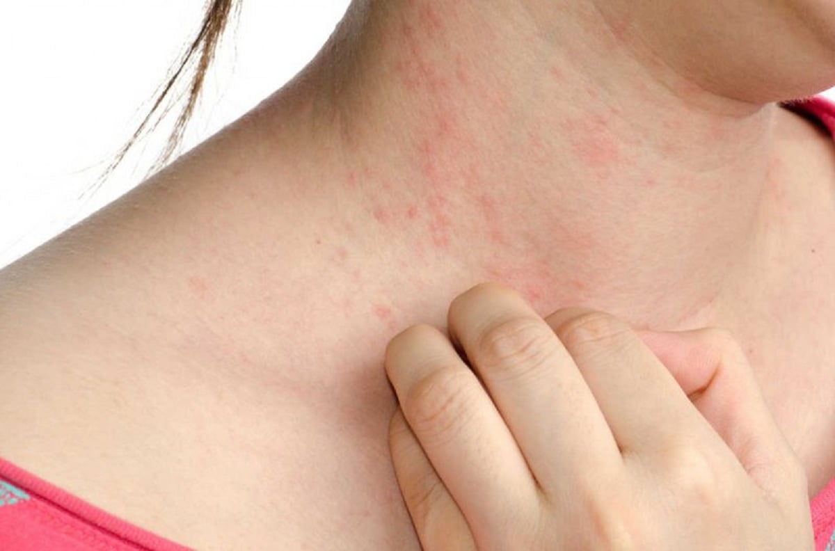   Da khô và ngứa ngáy là một trong những căn bệnh về da hay gặp  