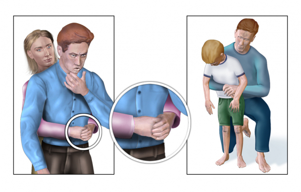   Với nạn nhân là người lớn hoặc trẻ lớn, người thực hiện sơ cứu đứng sau lưng trẻ, vòng hai tay ôm lấy thắt lưng trẻ để làm nghiệm pháp Heimlich. Ảnh minh họa  