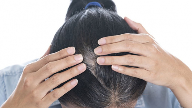 Hà thủ ô là một loại thảo dược quý giá với nhiều lợi ích cho tóc và da đầu. Nếu bạn đang tìm kiếm một giải pháp an toàn và hiệu quả để chăm sóc tóc đen tóc của mình, hãy xem hình ảnh liên quan đến từ khóa này để biết thêm thông tin về hà thủ ô.