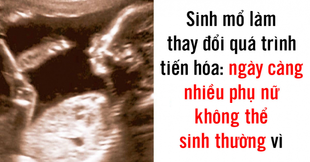 6 sự thay đổi ở cơ thể người cho thấy chúng ta vẫn đang tiến hóa 0