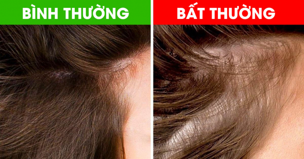 8 dấu hiệu bất thường từ mái tóc cảnh báo vấn đề sức khỏe trong cơ thể 0
