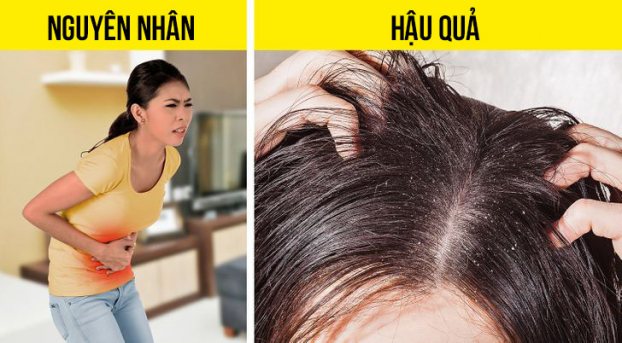 8 dấu hiệu bất thường từ mái tóc cảnh báo vấn đề sức khỏe trong cơ thể 2