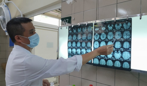   Hình ảnh phim cộng hưởng từ sọ não có tổn thương chất trắng lan tỏa trên não của bệnh nhân bị nhiễm độc thiếc  