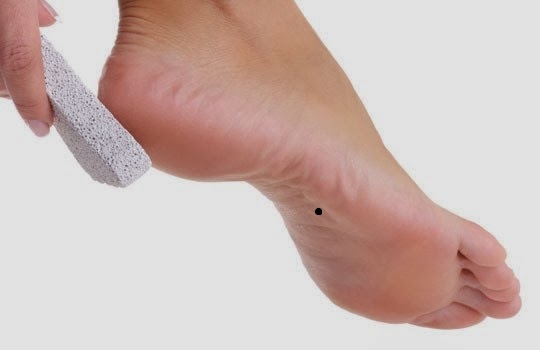   Nốt ruồi ở lòng bàn chân  