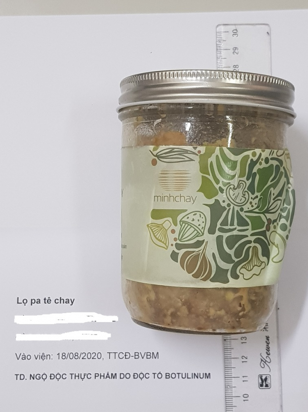   Sản phẩm Pate Minh Chay mà bệnh nhân sử dụng dẫn đến ngộ độc thực phẩm  