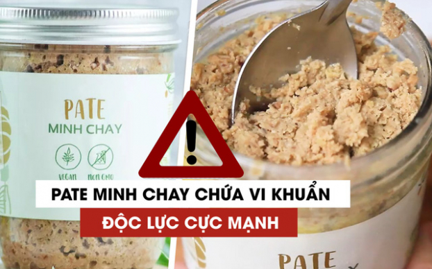   Phát hiện thêm các trường hợp ngộ độc sau khi ăn Pate Minh Chay. Ảnh minh họa  