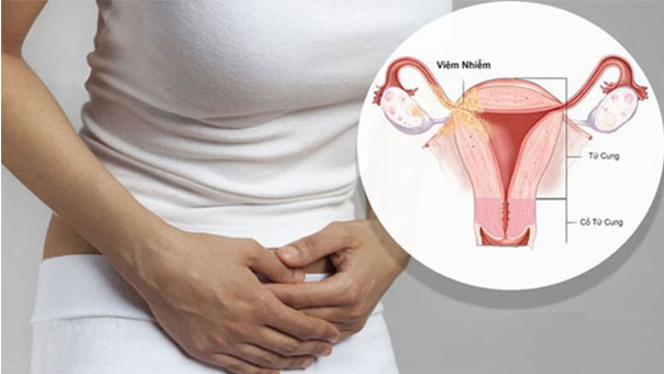 7 việc phụ nữ rất hay làm khiến bệnh phụ khoa thêm trầm trọng, cẩn thận ung thư cổ tử cung 0
