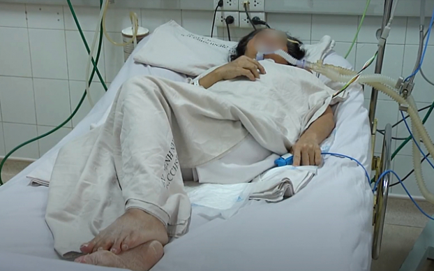   Một bệnh nhân ngộ độc Pate Minh Chay bị rối loạn tri giác vì hạ natri máu. Ảnh minh họa  
