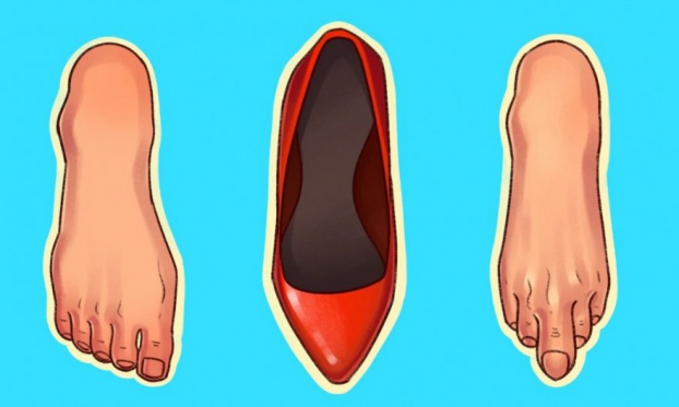 6 loại giày phổ biến tuy rất đẹp nhưng gây hại cho sức khỏe của bạn 0