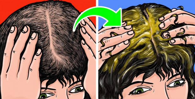 7 mẹo giúp tóc mọc lại tự nhiên và trị hói đầu hiệu quả 2