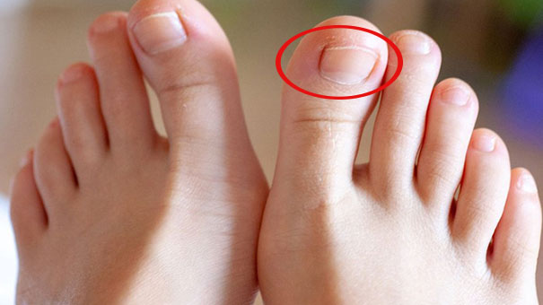3 dấu hiệu nhỏ trên bàn chân chứng tỏ bạn là người có sức khỏe tốt, sống lâu trăm tuổi 0
