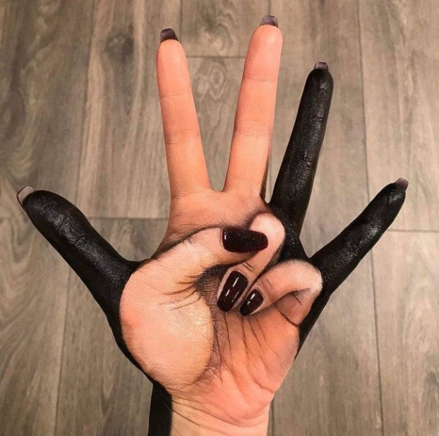   8 ngón tay trên 1 bàn tay  