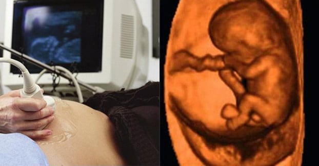   Siêu âm thai có thể phát hiện được dị tật thai trong thai. Ảnh minh họa  