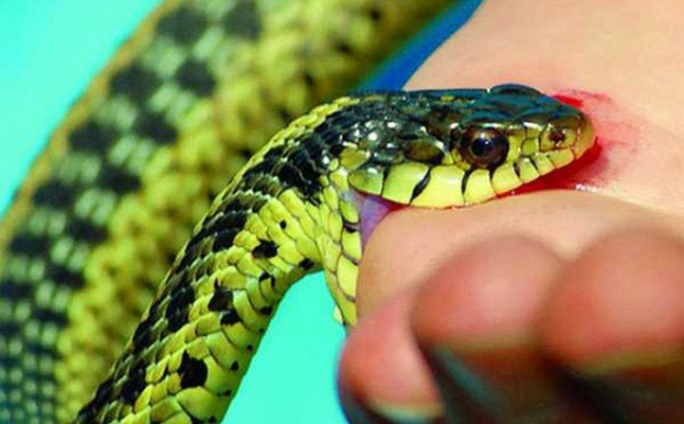   Người bị rắn độc cắn có nguy cơ bị hoại tử, nhiễm trùng máu, hay thậm chí là tử vong. Ảnh minh họa  