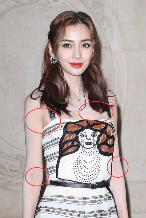 Địch Lệ Nhiệt Ba, Angelababy và loạt mỹ nhân Cbiz ê chề vì bị bóc mẽ sự thật làn da trắng 2