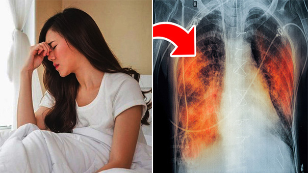3 biểu hiện sau khi ngủ chứng tỏ phổi của bạn đang bị tổn thương nghiêm trọng 0