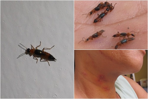   Tuyệt đối không dùng tay diệt kiến ba khoang, trong kiến ba khoang có chất độc khi tiếp xúc sẽ bị ngứa, bỏng rát da  