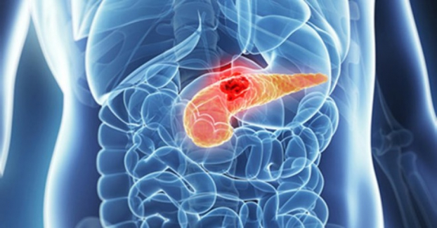 3 loại ung thư âm thầm phá hủy cơ thể bạn, khi phát hiện đã quá muộn không thể chữa trị 2