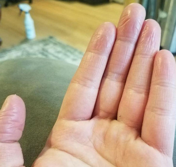   Không một ngón tay nào của tôi có vân tay cả  