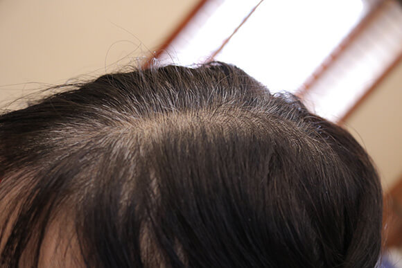 7 yếu tố âm thầm khiến người trẻ tóc bạc sớm 2
