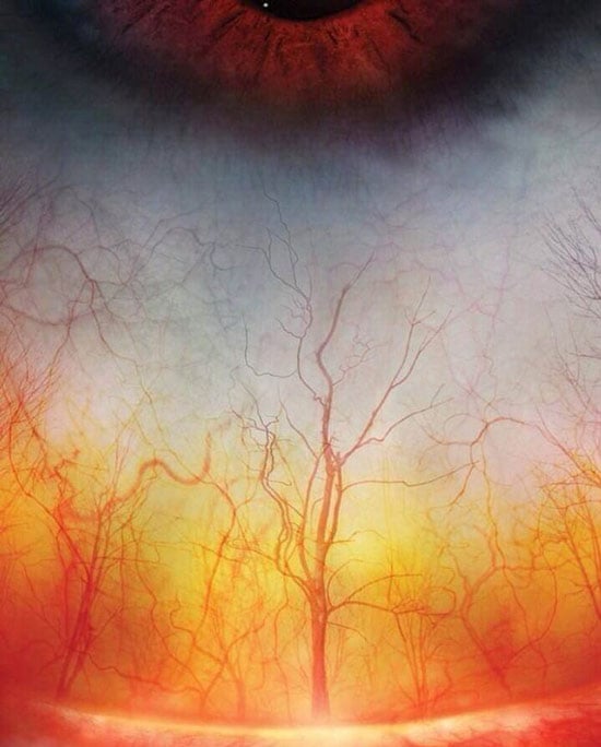   Không phải rừng cây đâu, đây thực chất là ảnh phóng to các mạch máu trong mắt của chúng ta đấy.  