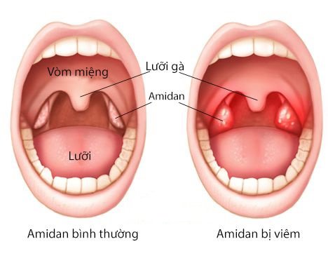 11 bộ phận thừa thãi, vô dụng nhất trên cơ thể người có thể 'biến mất' trong tương lai 10