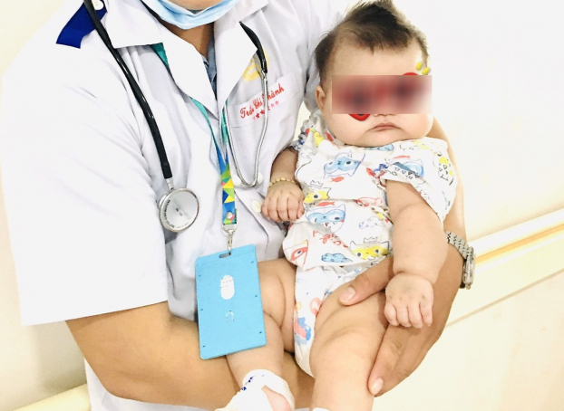   Trắng trẻo, bụ bẫm, bé 6 tháng tuổi nhập viện vì lý thiếu dinh dưỡng  