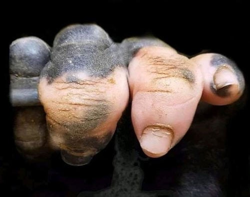   Đây là ngón tay bị bạch tạng của khỉ bị đột biến và giống hệt với ngón tay người chứ hoàn toàn không phải tay người đâu  
