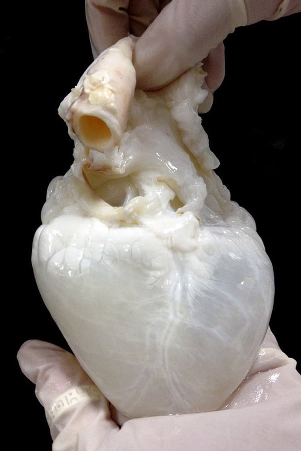   Quả tim màu trắng dưới đây là quả tim của người hiến tặng sau khi đã được tẩy sạch các tế bào, chỉ còn lại cấu trúc protein. Trước khi tiến hành cấy ghép, quả tim sẽ được tiêm vào tế bào gốc của người nhận nhằm tránh việc bị cơ thể mới đào thải.  