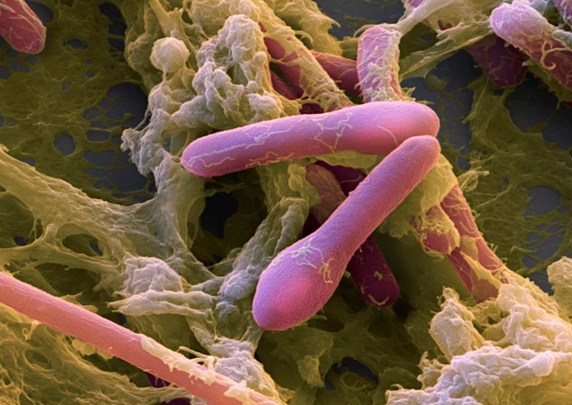   Vi khuẩn Clostridium botulinum dưới kính hiển vi điện tử. Ảnh minh họa  