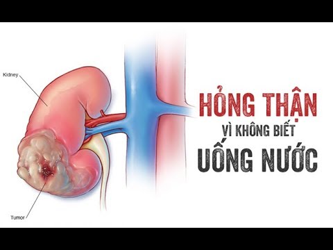 Những món ăn mà 5 cơ quan nội tạng sợ hãi nhất, muốn sống thọ nên bỏ càng sớm càng tốt 1