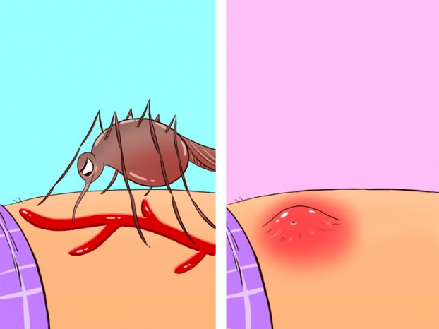 Điều gì xảy ra với cơ thể chúng ta khi bị muỗi đốt? 5
