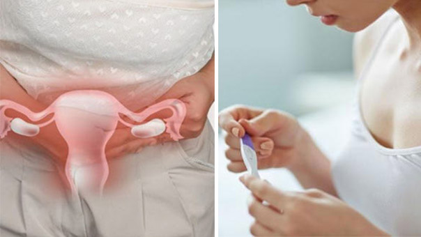 3 điều đáng sợ nhất ở tử cung mà phụ nữ phải đối mặt, bỏ ngay nếu không muốn vô sinh 0
