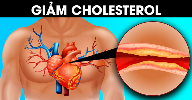 5 thay đổi trong lối sống giúp giảm cholesterol, hạn chế nguy cơ bệnh tim, đột quỵ 0