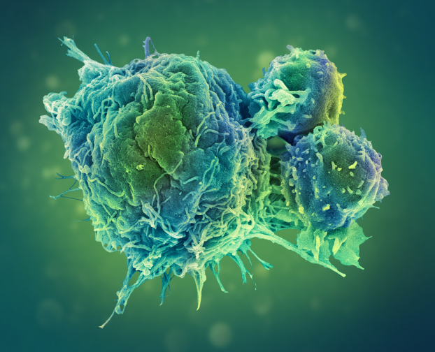  Liệu pháp miễn dịch điều trị ung thư giúp tăng cường sức đề kháng chống lại các tế bào ung thư một cách có chọn lọc  