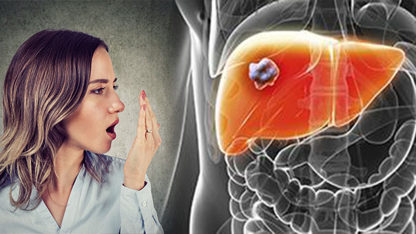 3 bộ phận trên cơ thể ‘bốc mùi’, chứng tỏ gan bị tổn thương đang chuyển thành ung thư 0