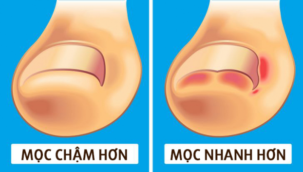 Vì sao móng tay mọc dài nhanh hơn móng chân? 4