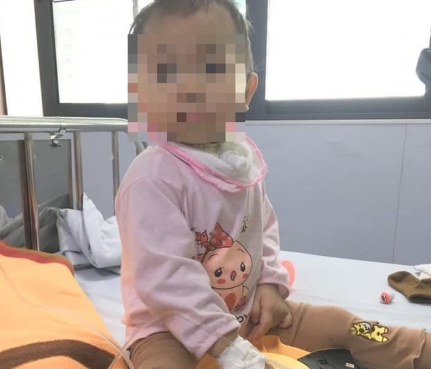  Bé gái 19 tháng tuổi bị tay chân miệng biến chứng nặng, suy hô hấp, liệt 2 chân được bác sĩ chữa trị thành công  