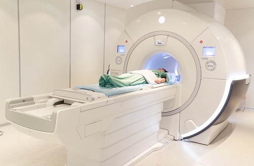 Đột quỵ não và vai trò của chụp cộng hưởng từ (MRI) trong tầm soát đột quỵ 3