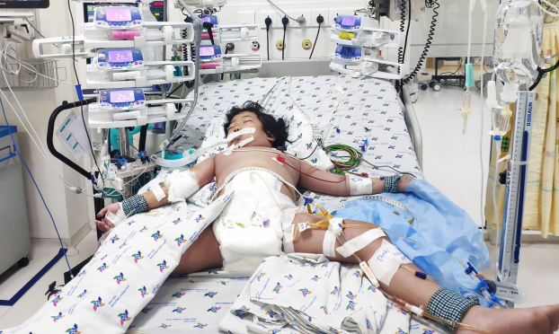   Bé gái 5 tuổi bị sốc sốt xuất huyết nặng, cận kề cửa tử được các bác sĩ cứu sống thành công  