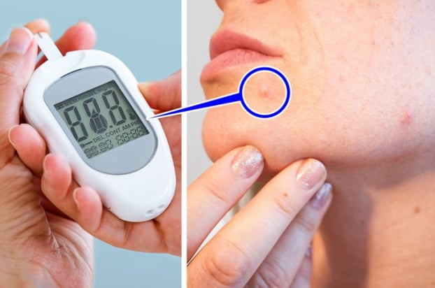 Điều gì sẽ xảy ra nếu bạn uống cà phê đầu tiên trước khi ăn sáng? 5