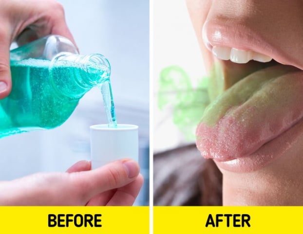 Vì sao bạn đánh răng sạch sẽ mà ngủ dậy vẫn bị hôi miệng? 6 cách trị hôi miệng tại nhà 1