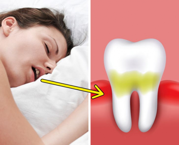 Vì sao bạn đánh răng sạch sẽ mà ngủ dậy vẫn bị hôi miệng? 6 cách trị hôi miệng tại nhà 2