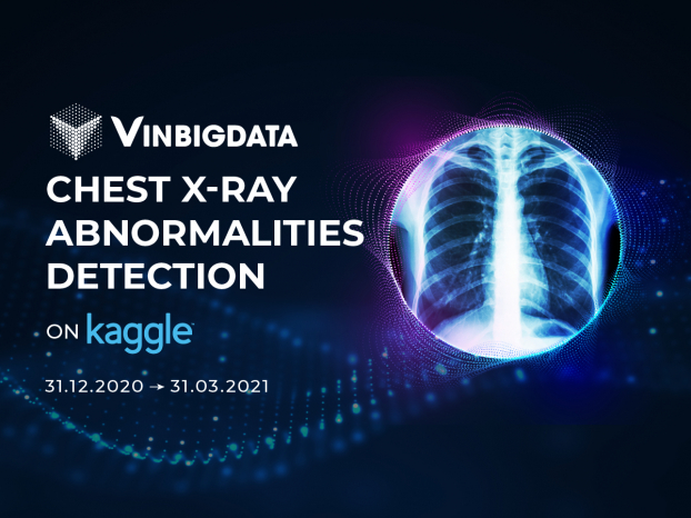   Cuộc thi “Ứng dụng AI phát hiện điểm bất thường trên ảnh X-quang lồng ngực” do Viện Nghiên cứu Dữ liệu lớn VinBigdata - Tập đoàn Vingroup tổ chức trên Kaggle, sân chơi uy tín dành cho cộng đồng khoa học dữ liệu  