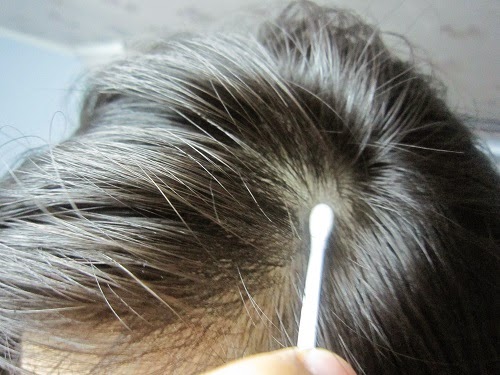Cách trị rụng tóc bằng dầu dừa giúp bạn lấy lại mái tóc dày và đen óng 1