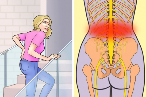 7 thói quen có thể khiến bạn bị đau lưng dưới và cách phòng tránh 5