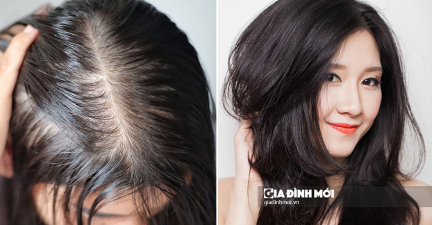 3 công thức chống rụng tóc cho mái tóc dài khỏe ngay tại nhà 0
